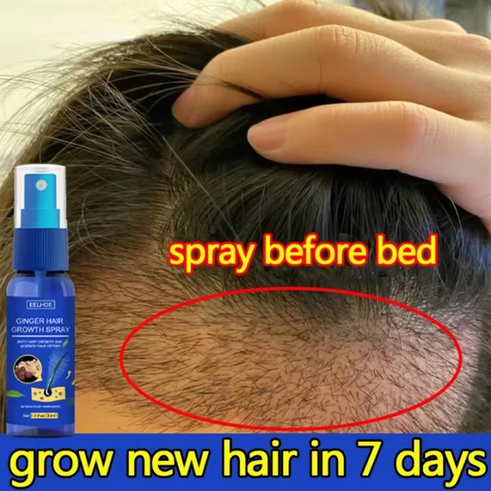 Hair Care For Hair Loss - Schnelles Ingwer-Haarwuchsspray für Wurzelwachstum, Anti-Haarausfall, Haarwuchs-Serum,