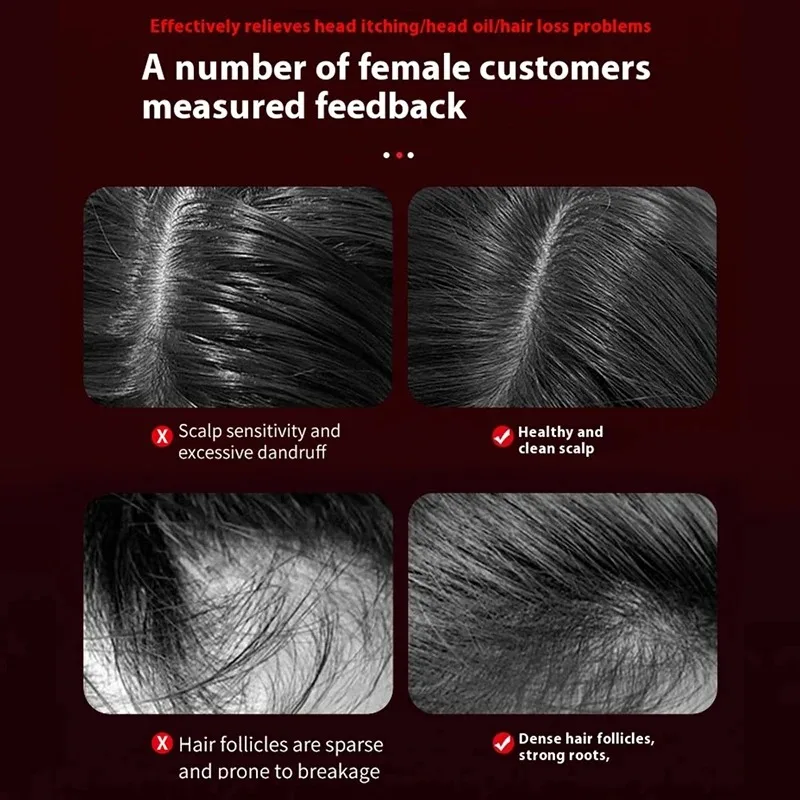 Elektrischer Vibrations-Massag – Hair Care For Hair Loss Bewertung und Preis