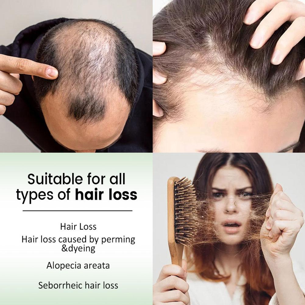 1/2 Stück Rosmarin-Haarshampoo – Rosemary Hair Oil Bewertung und Preis