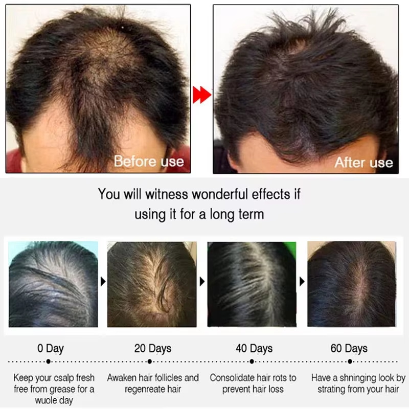 Schnelles Ingwer-Haarwuchsspra – Hair Care For Hair Loss Bewertung und Preis