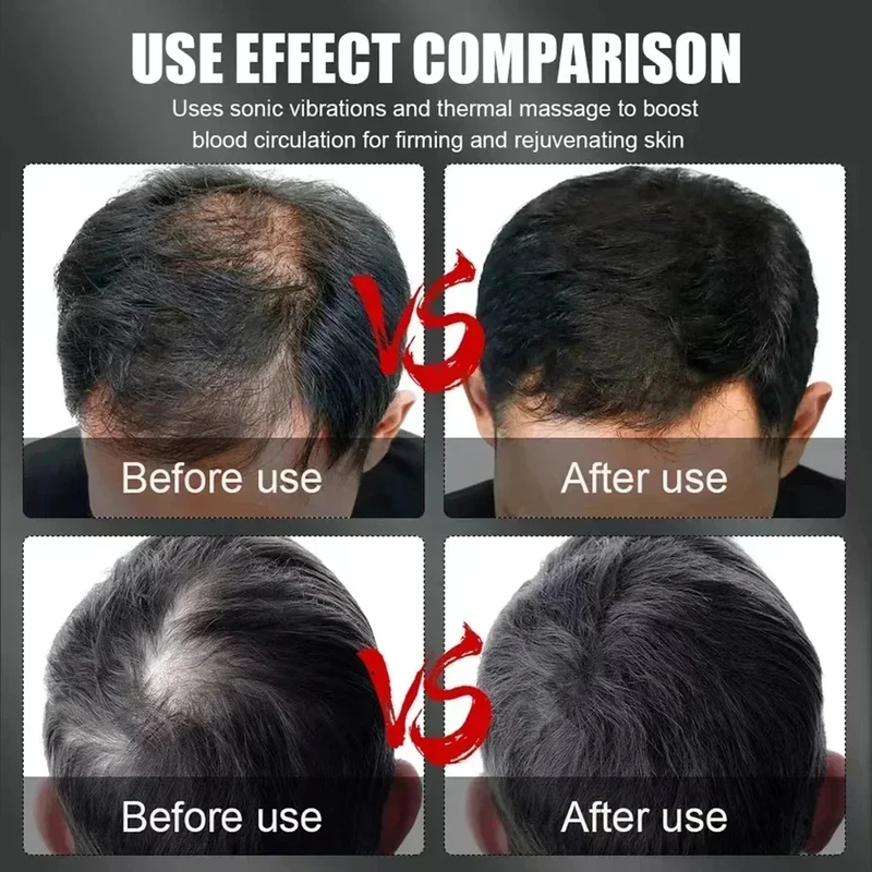 660nm 850nm Rotlicht-Infrarot- – Hair Care For Hair Loss Bewertung und Preis